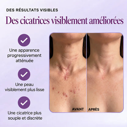 Gel réparateur de cicatrices