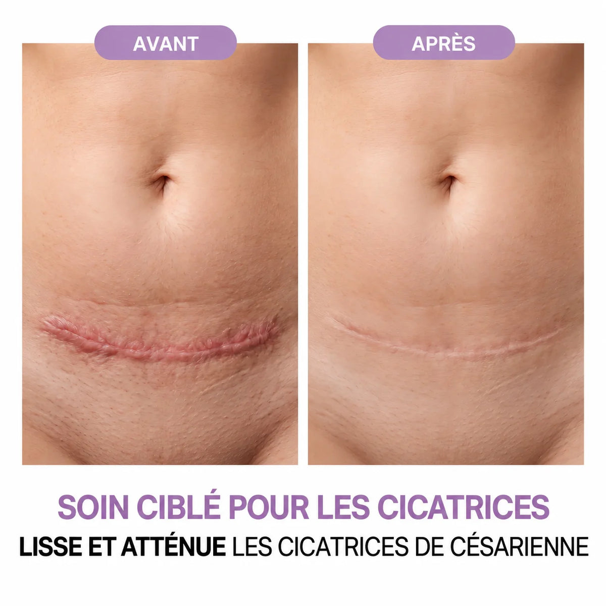Gel réparateur de cicatrices