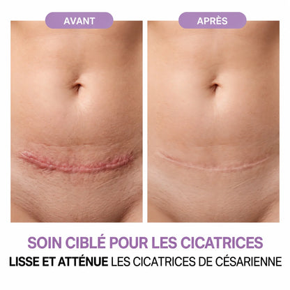 Gel réparateur de cicatrices