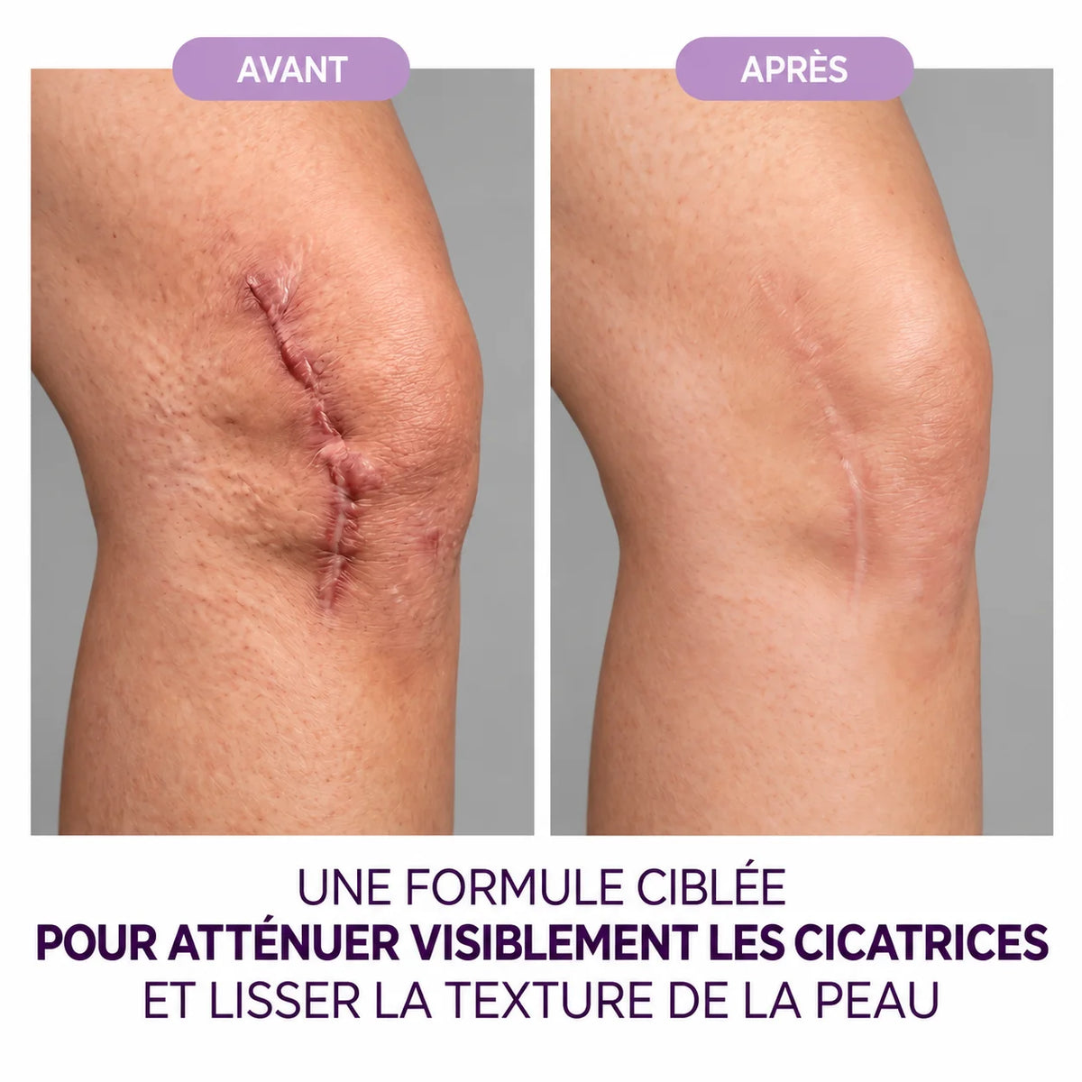 Gel réparateur de cicatrices