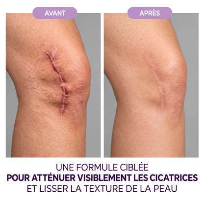 Gel réparateur de cicatrices