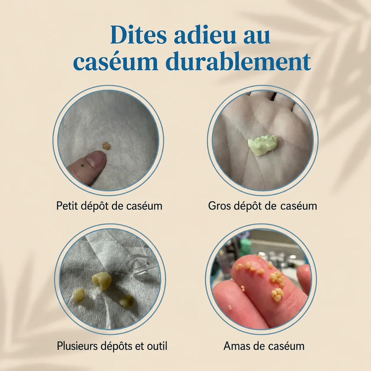 Spray Anti-Caséum pour Amygdales – Haleine Fraîche