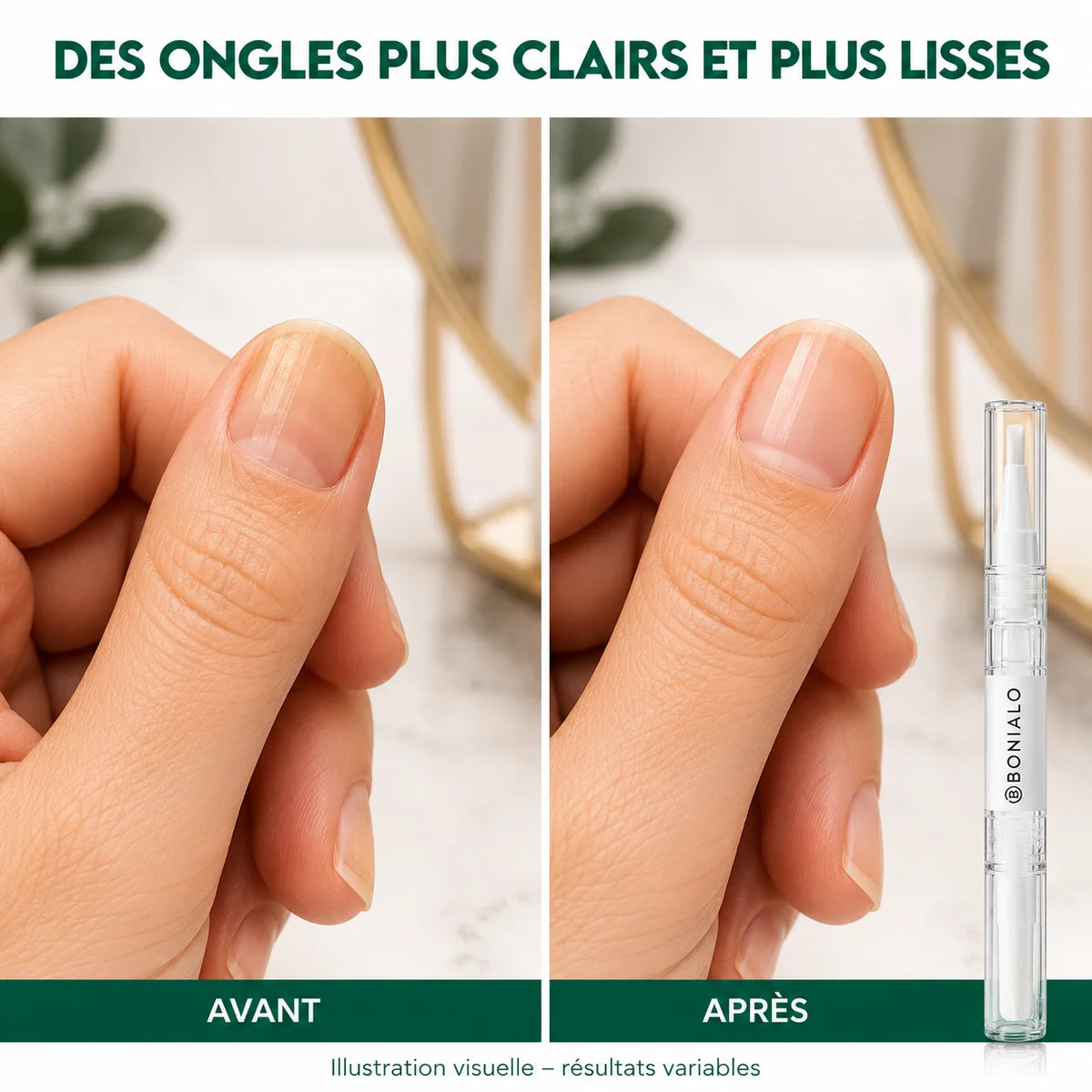 Stylo Anti-Mycose des Ongles